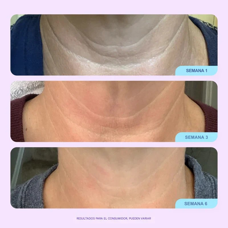 Crema Gopure | Rejuvenece tu Cuello y Escote.