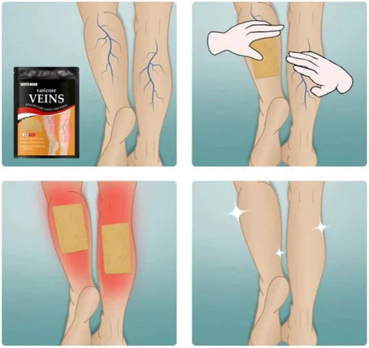 Varix Care Parches para Varices (Pack X3). 36 unidades