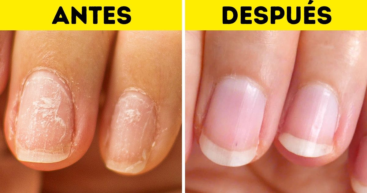 Mani Pro 5 en 1. Kit Para Uñas