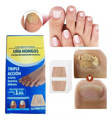 🩹 Hongo Stop. Parches para hongos uñas x 3 cajas de 16 unidades c/u.