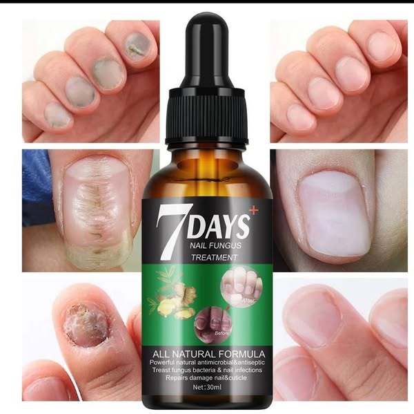 Serum para hongos en uñas | Dile adiós a los molestos hongos.