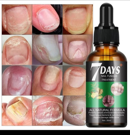 Serum para hongos en uñas | Dile adiós a los molestos hongos.