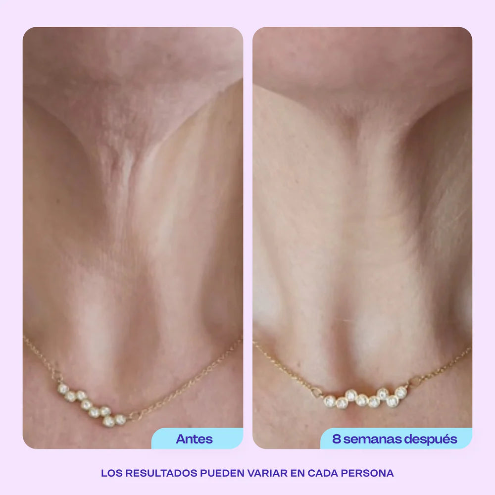 Crema Gopure | Rejuvenece tu Cuello y Escote.