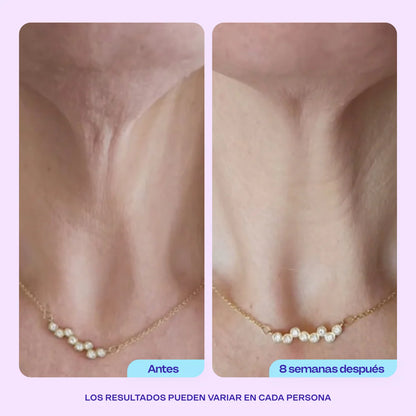Crema Gopure | Rejuvenece tu Cuello y Escote.