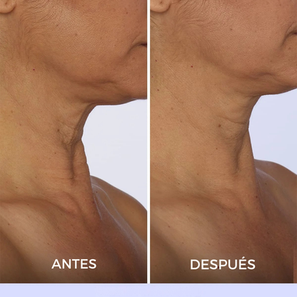 Crema Gopure | Rejuvenece tu Cuello y Escote.