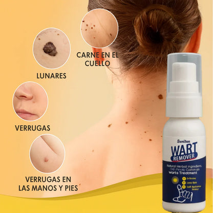 Crema Removedora de Verrugas y Lunares Wart Remover | Elimina con suavidad y rapidez