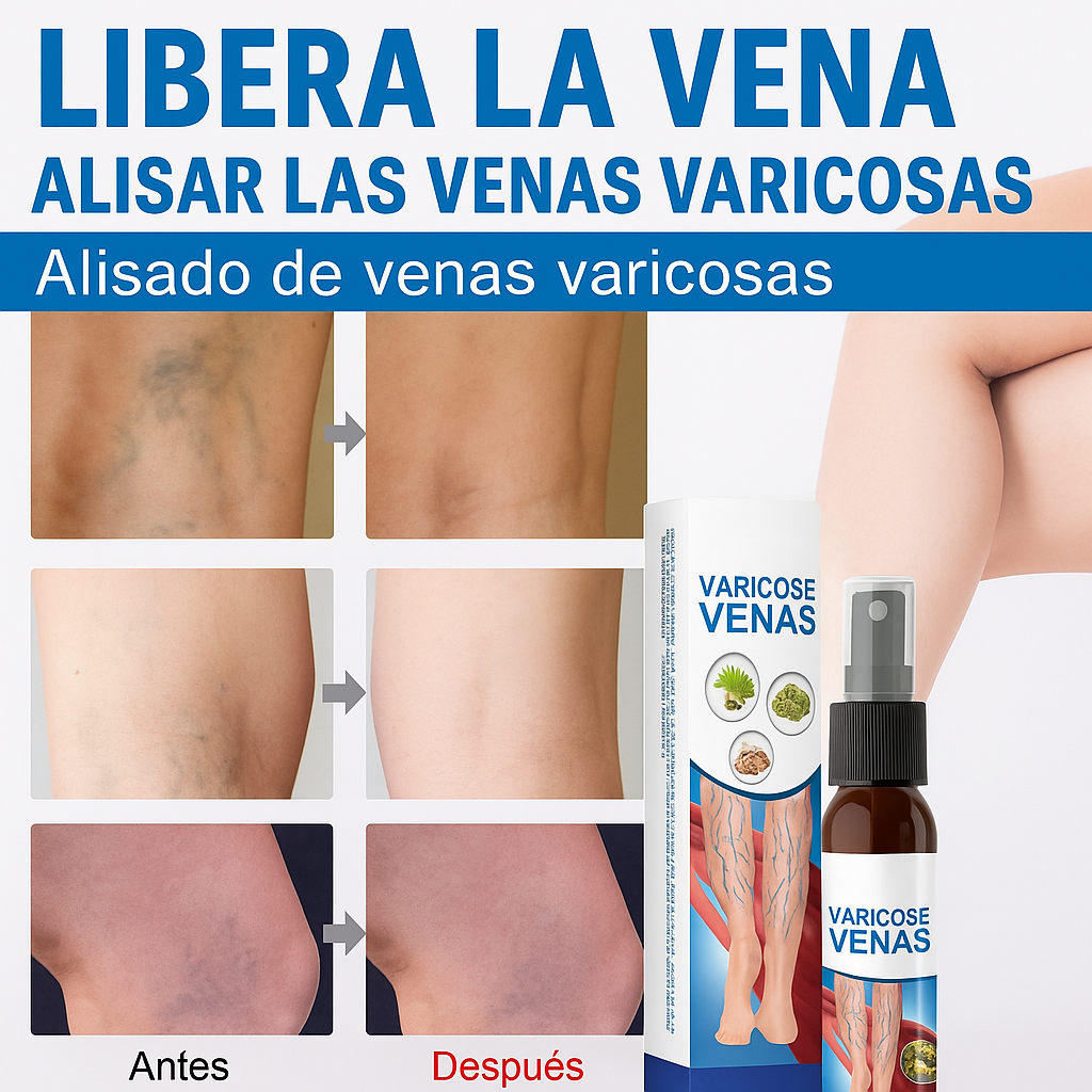 Spray Para Várices - Dale Alivio a tus Piernas. De Regalo 12 Parches para Várices