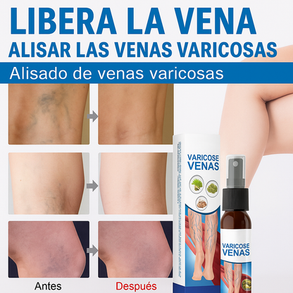 Spray Para Várices - Dale Alivio a tus Piernas. De Regalo 12 Parches para Várices