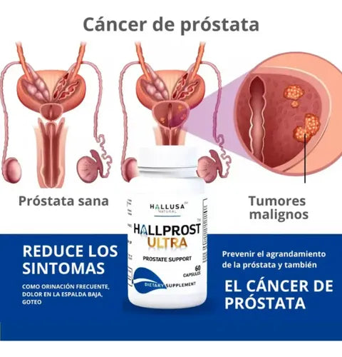 Hall Prost Ultra | Tratamiento Completo 60 Cápsulas.