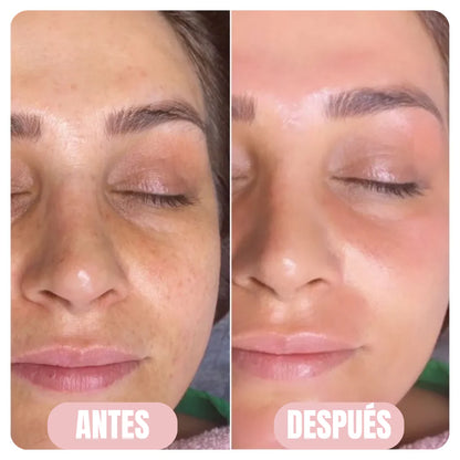 Glass-Mascarilla de Colágeno | Elimina Arrugas y Recupera Firmeza.