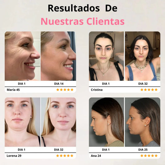Lifting Facial Skindion - Piel firme y sin arrugas!