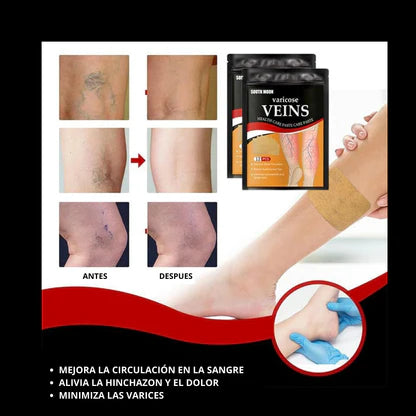 Varix Care Parches para Varices (Pack X3). 36 unidades